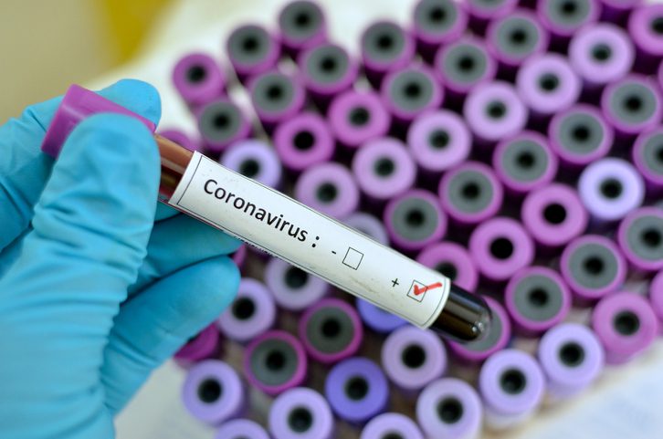 Celebrities having Coronavirus